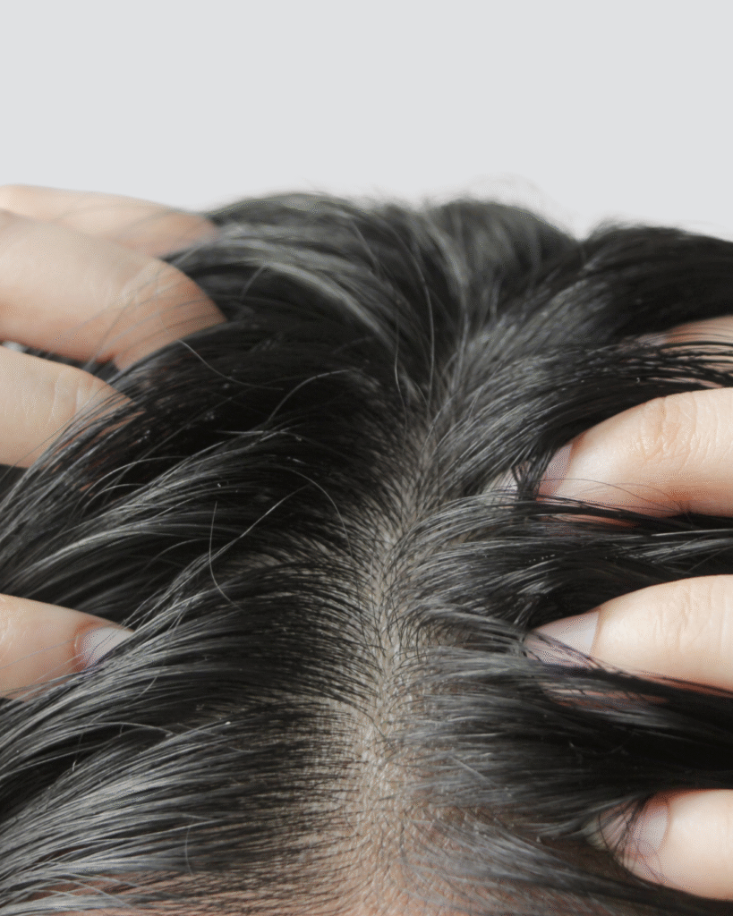 Oily Scalp