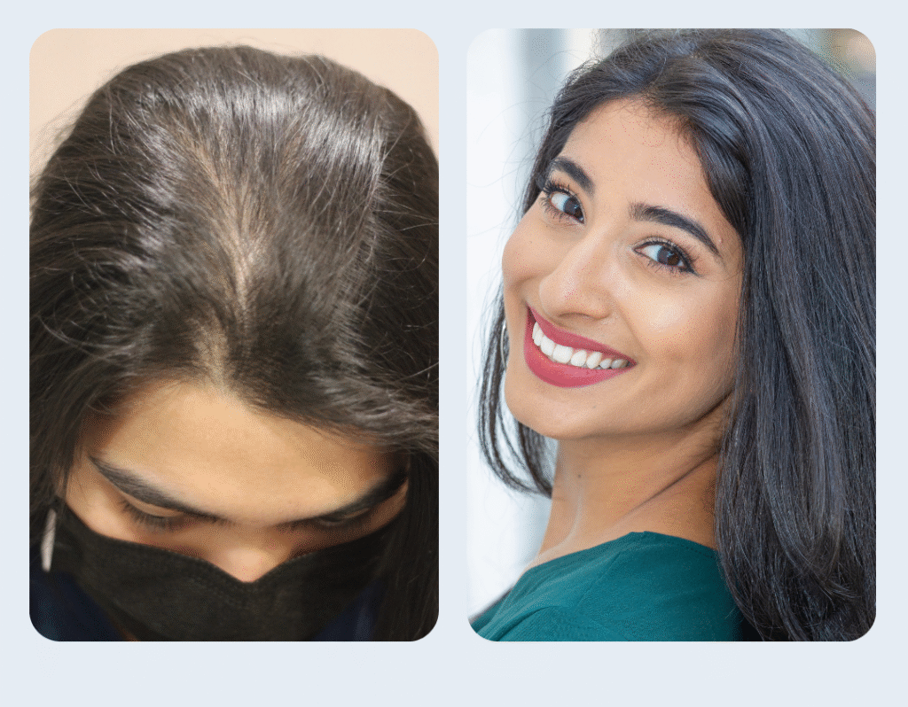 Aglow Hair Testimonials - Before / After Lydia Retchumi